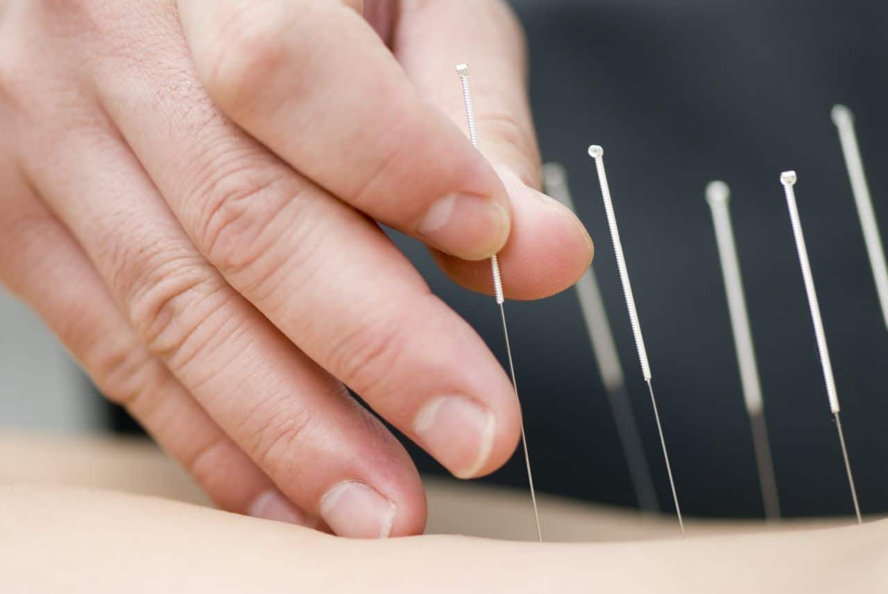 Acupuncture for ICBC clients in Surrey, North Vancouver and Burnaby
